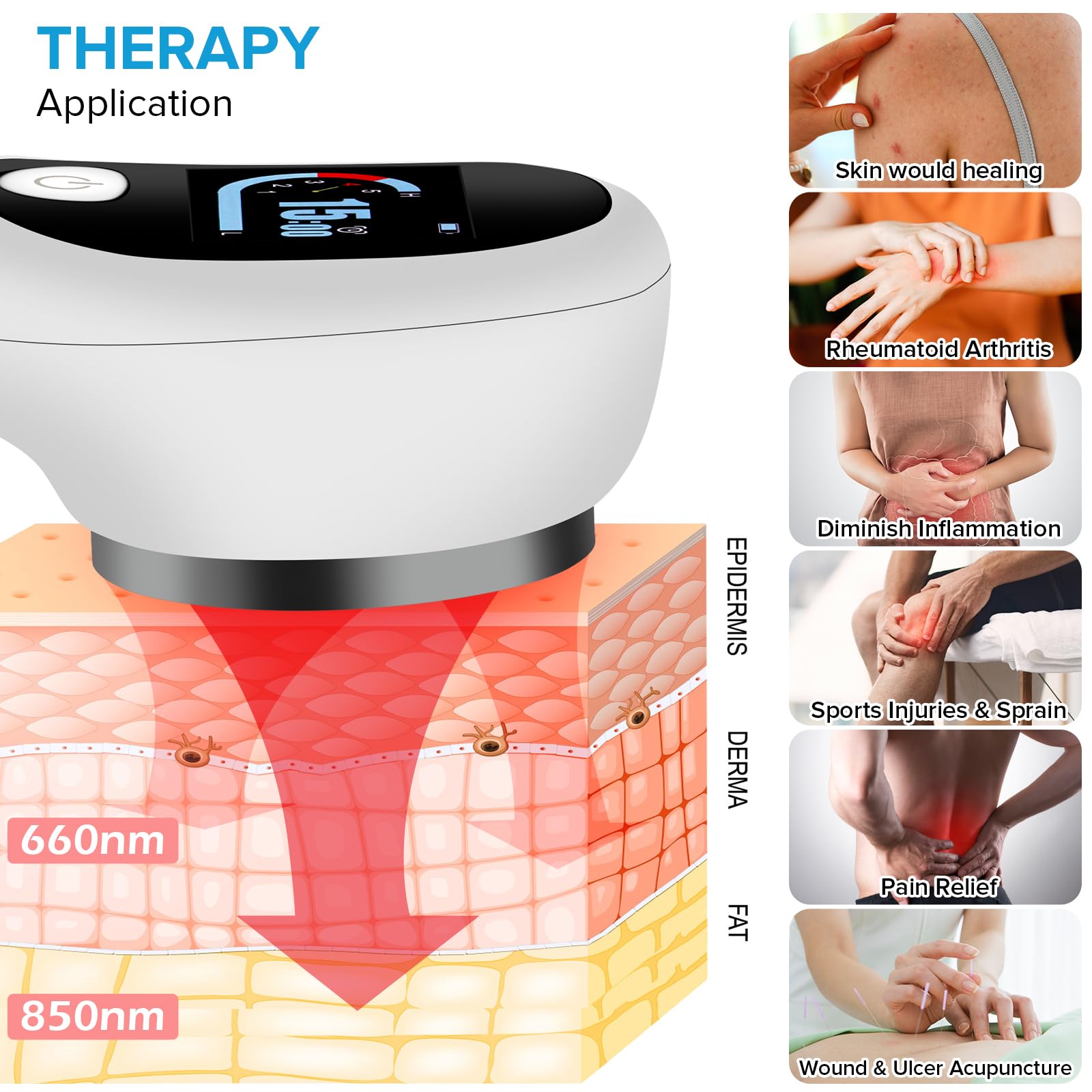yofalo Cold Laser Human/Vet Device with LED Display Targets Joint and Muscles Directly
